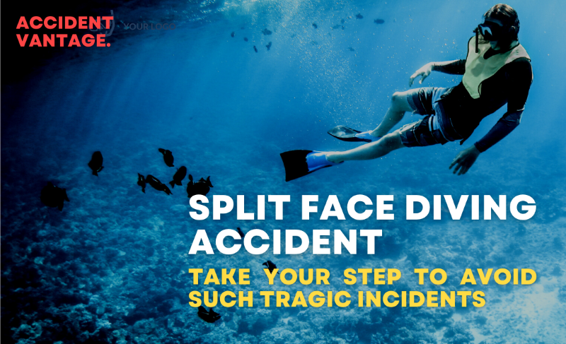 split face diving accident